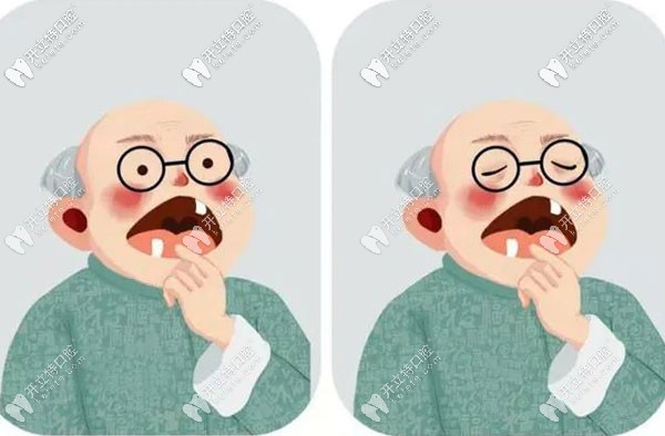 試問種植牙咀嚼功能怎么樣,和自己的真牙咀嚼效率一樣嗎？