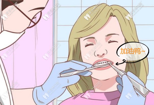 <!--<i data=20240703-sp></i>-->口腔窟牙費用