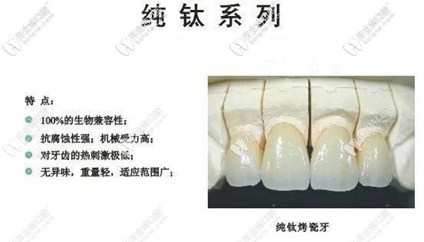 純鈦聚合瓷和烤瓷的區(qū)別大不，后槽牙缺失選哪個更耐用