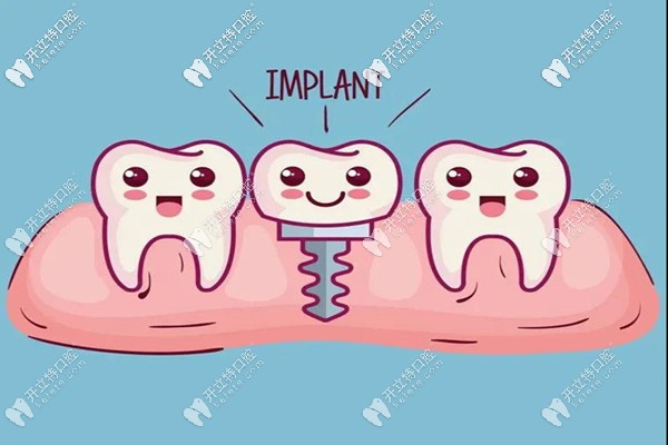 邢臺種植牙一般多少錢一顆,還想打卡醫(yī)生技術好的牙科