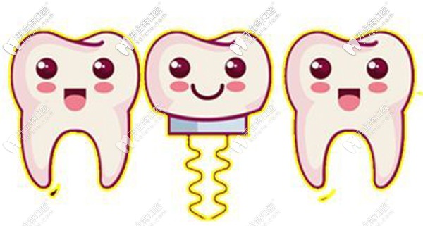 廣州馬瀧齒科種植牙價(jià)格