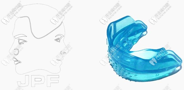 jpf兒童肌功能矯治器矯正效果好不好?它與MRC適應(yīng)癥有區(qū)別嗎