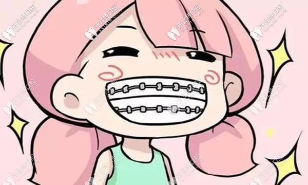 攀枝花明皓口腔矯正牙齒怎么樣,鎖定周虎躍院長的正畸技術(shù)