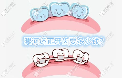 其實想在漯河矯正牙齒價格并不貴,認準這幾家牙科就ok