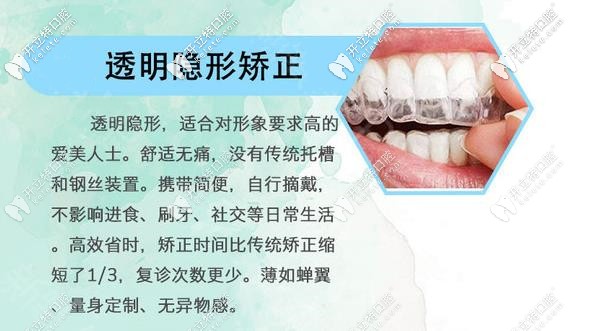 094-隱形牙套優(yōu)勢(shì)_副本.jpg