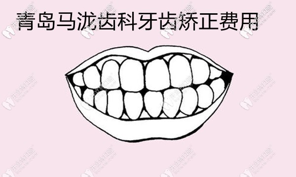 青島馬瀧齒科矯正費(fèi)用擱這兒呢,找張晗博士做正畸價(jià)格貴嗎