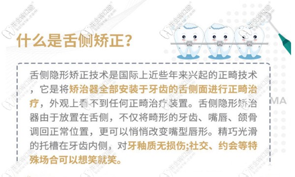 青島馬瀧齒科的正畸價(jià)目表