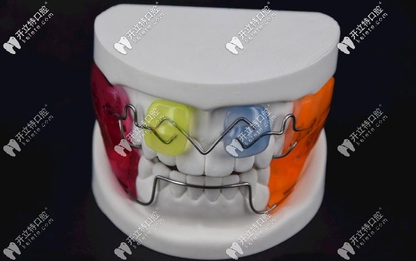 兒童矯治器法蘭克3該怎么調(diào)節(jié),附fr3的使用方法和適應癥