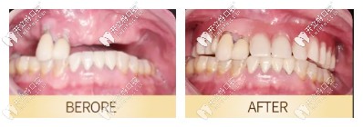 昆明柏德口腔案例