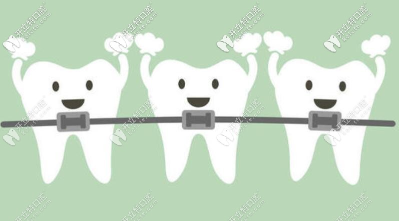 金屬矯正 金屬矯正