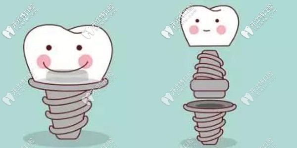 綿陽口腔醫(yī)院收費(fèi)標(biāo)準(zhǔn)更新，種植牙/矯正牙齒價(jià)格同步更新~