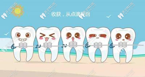 在綿陽做牙齒正畸的費(fèi)用價格如下