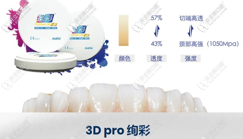 愛迪特的3D Pro 絢彩氧化鋯全瓷牙冠特性