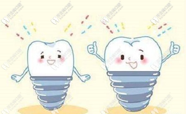 柳州各牙科種植牙費(fèi)用匯總