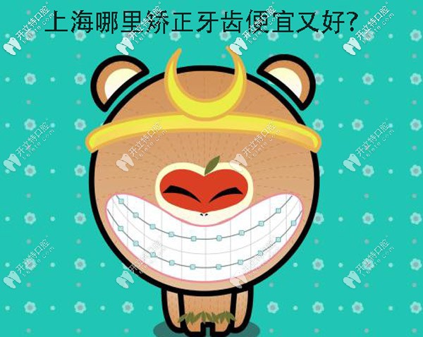 上海哪里矯正牙齒便宜又好呀?想選個正規(guī)的牙科醫(yī)院整牙