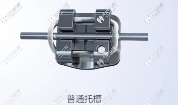 普通金屬托槽有扎絲