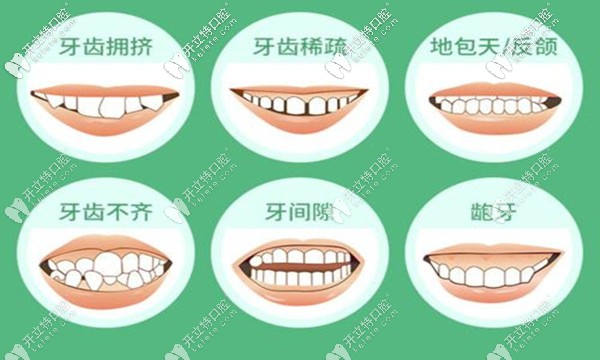 承德可米口腔牙齒矯正