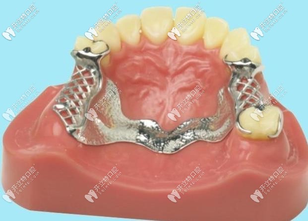 德國拜耳牙和日本松風(fēng)塑鋼牙哪個(gè)好呢?兩者材質(zhì)有區(qū)別嗎