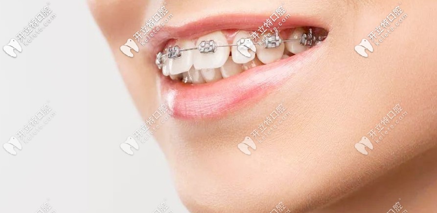 劇透南陽(yáng)口腔醫(yī)院收費(fèi)價(jià)格表，正畸和種牙費(fèi)用還不貴呢