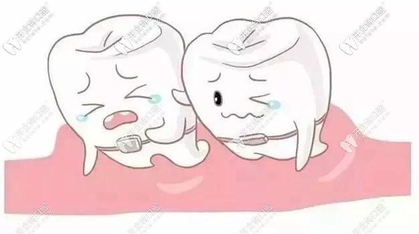 九江牙齒矯正的費用