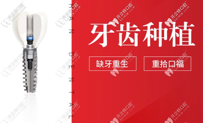 貴陽(yáng)德韓口腔種植牙怎么樣？種牙技術(shù)好的醫(yī)生介紹奉上