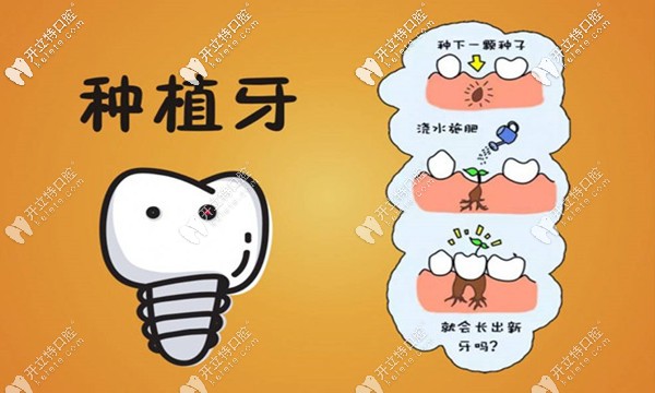 欒城區(qū)固德口腔種植牙一顆多少錢