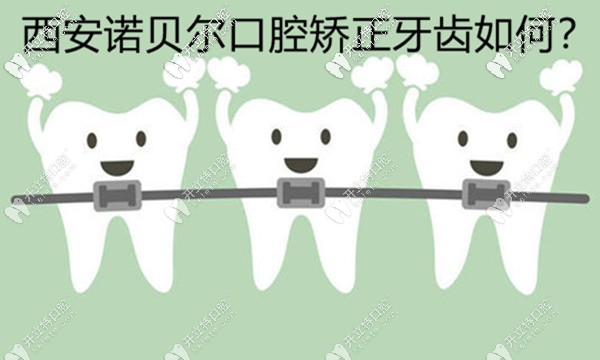 西安諾貝爾口腔矯正牙齒好不好，用正畸病例來(lái)評(píng)價(jià)下