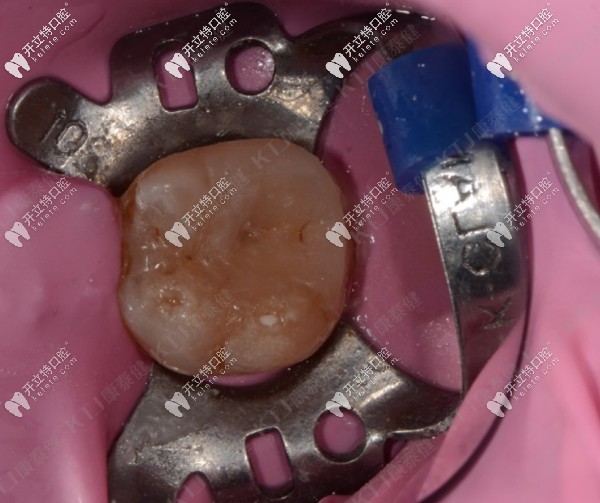 清除殘留的水門汀及邊緣拋光