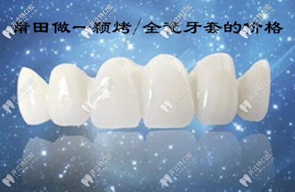 莆田做一顆烤/全瓷牙套的價格