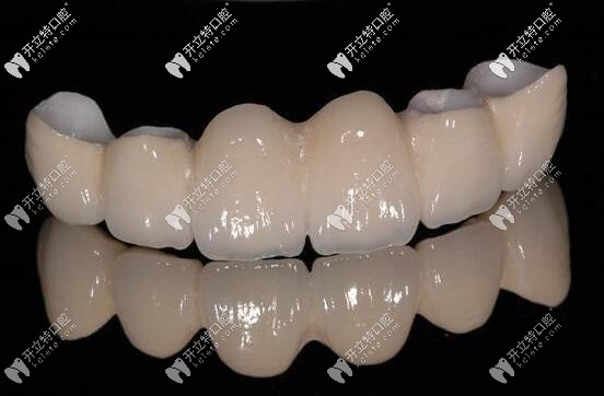 韓國(guó)登騰全瓷牙