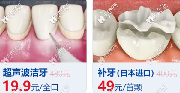 曙光口腔洗牙、補牙優(yōu)惠看這