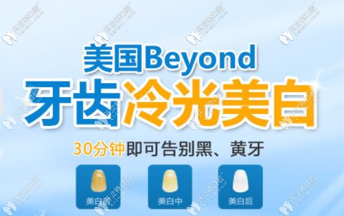 Beyond冷光美白技術(shù)