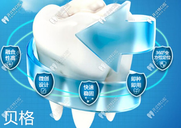 深圳勝健口腔德國貝格種植牙優(yōu)勢