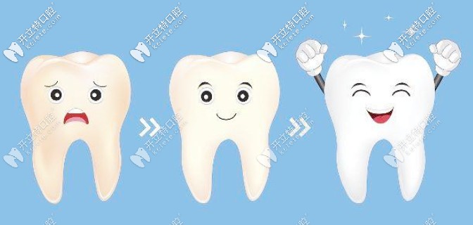 美白牙齒的方法有哪些？這有美牙五大方法效果及優(yōu)勢對比