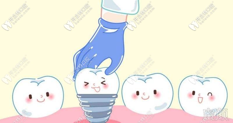 牙齒缺失種植牙解決