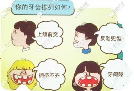 記錄3歲孩子佩戴羅慕兒童早期矯正器過程，真有必要矯正哦