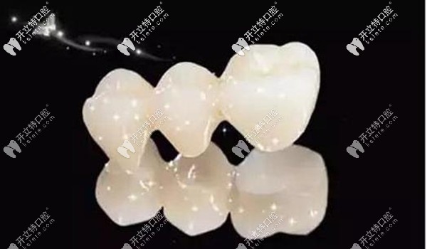 西安美奧口腔全瓷牙價(jià)格就在這,不要擔(dān)心國(guó)產(chǎn)愛(ài)爾創(chuàng)收費(fèi)貴