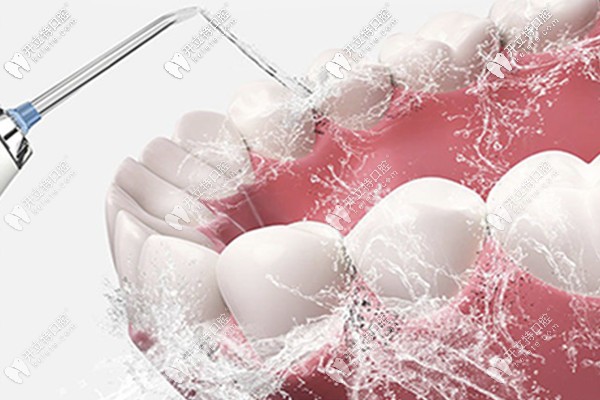 法國賽特力p5潔牙VS超聲波洗牙的區(qū)別除了價格還有...