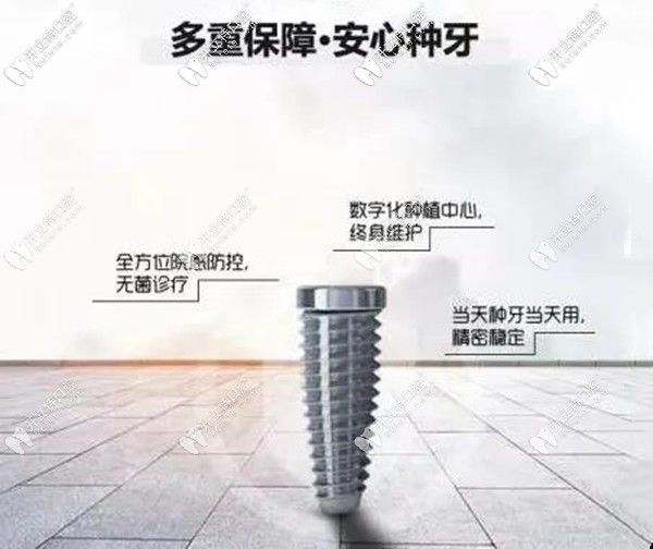 廈門麥芽與瑞典諾保科種植體聯(lián)合,做Nobel種植牙可終身質(zhì)保