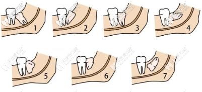 銅川惠美佳口腔價(jià)格表一覽,洗牙補(bǔ)牙費(fèi)用也就是一頓飯錢(qián)