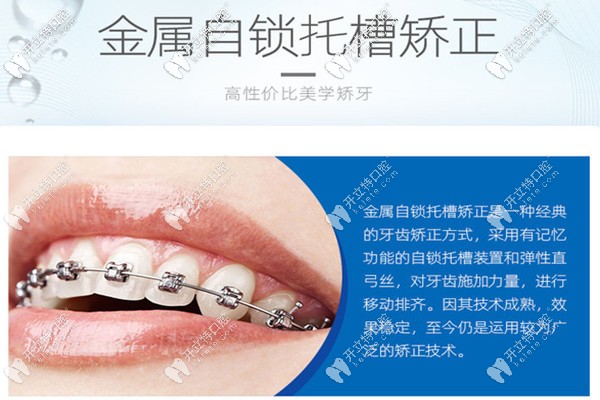 汕頭傳統(tǒng)牙齒矯正多少錢(qián)