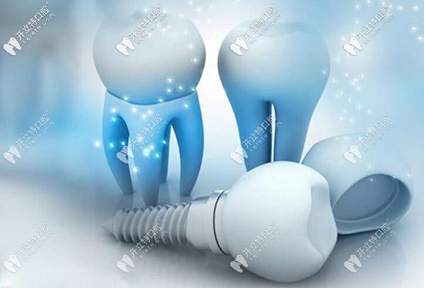 種植牙選純鈦和鈦合金材料有啥區(qū)別，做核磁共振有影響嗎