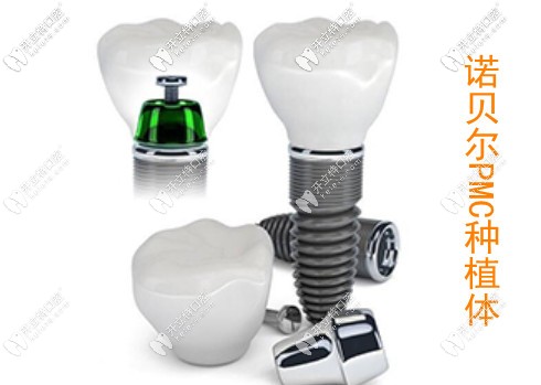 瑞典諾貝爾PMC種植體