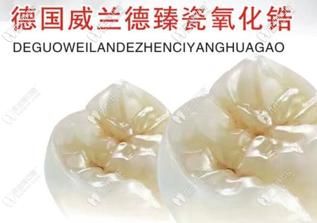 整理了德國烤瓷牙價(jià)格表,威蘭德澤康幾種牙套品牌也在其中