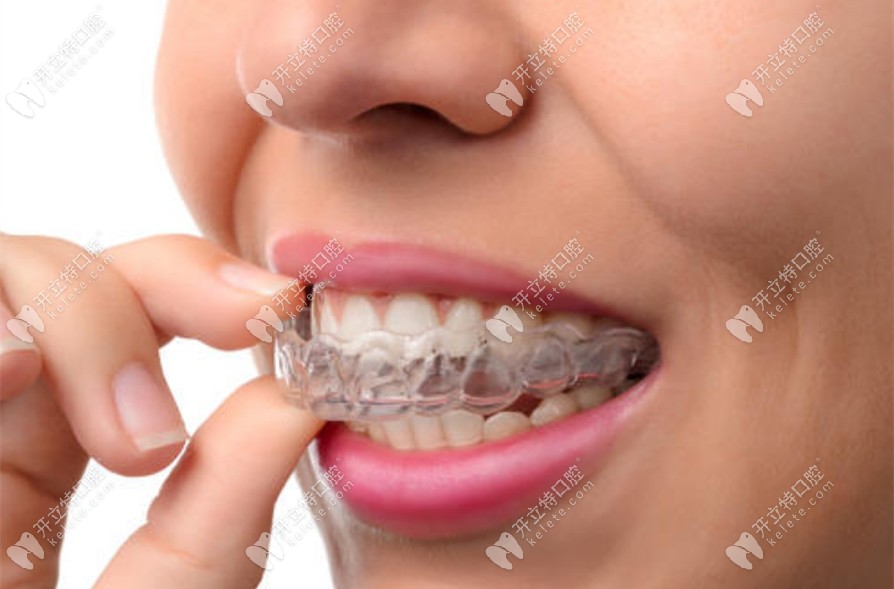都江堰華藝口腔隱形矯正