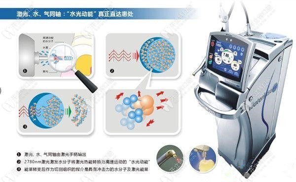 水激光種植的過(guò)程