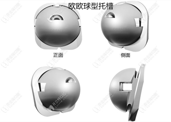 OBrace球面自鎖托槽的外觀