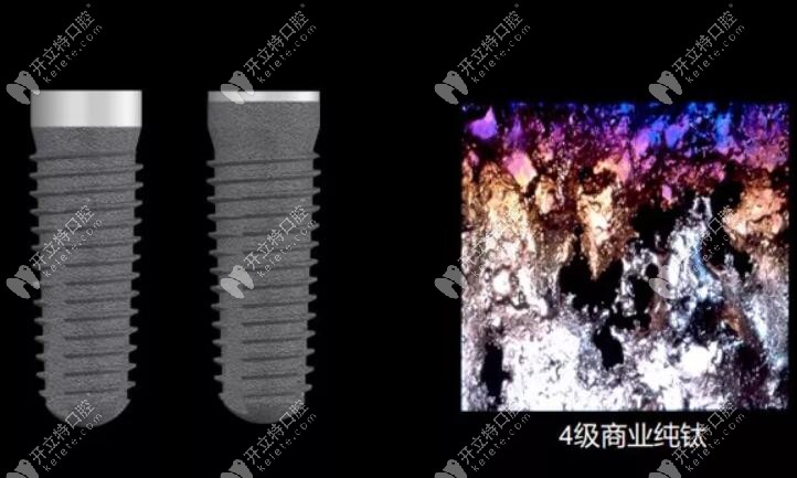 德國進(jìn)口種植體品牌camlog好不好？看其材質(zhì)性價比蠻高的