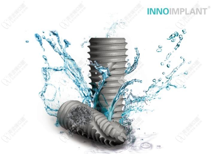 親水性的伊諾種植體系統(tǒng)