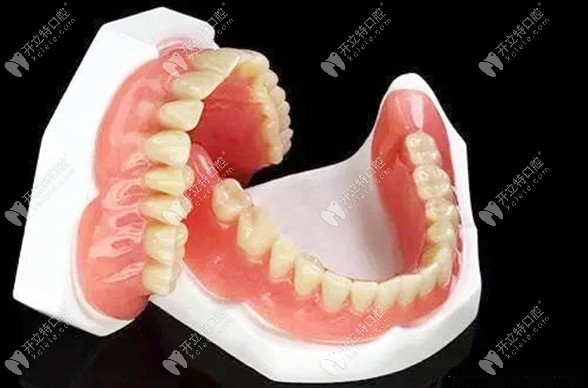 吸附性義齒可以當(dāng)天佩戴即刻進(jìn)食